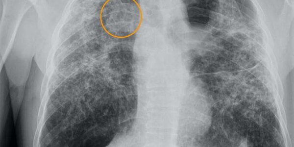 Article teaser image