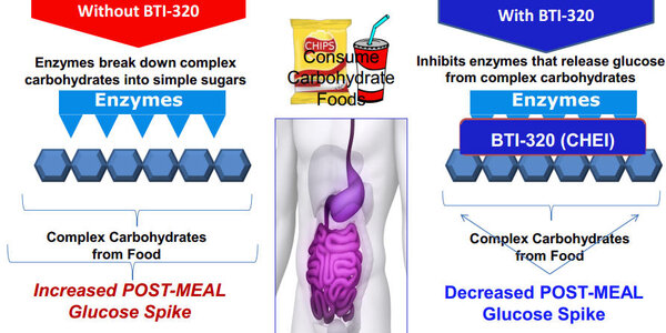 Article teaser image