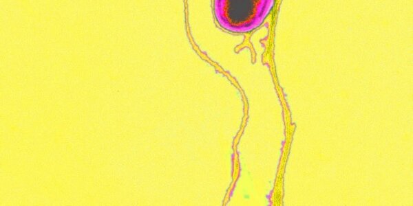 Article teaser image