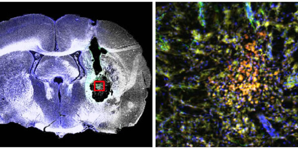 Article teaser image