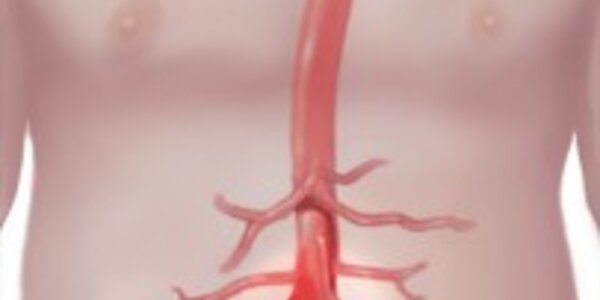 Article teaser image