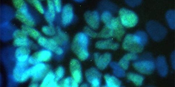 Article teaser image