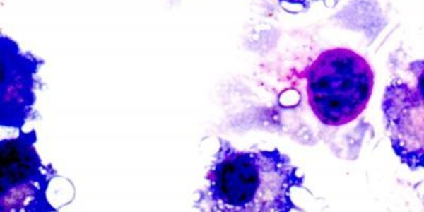 Article teaser image