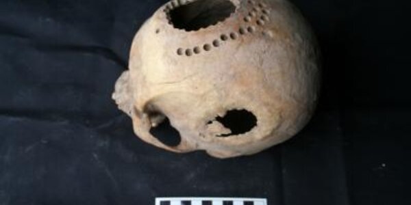 Article teaser image