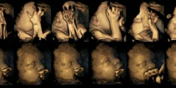 Article teaser image