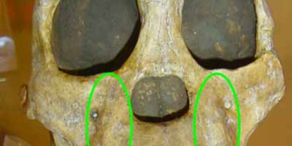 Article teaser image