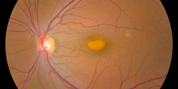 Article teaser image