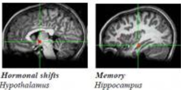 Article teaser image