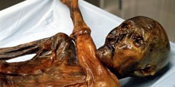 Article teaser image