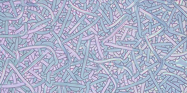 Article teaser image