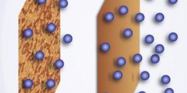 Article teaser image