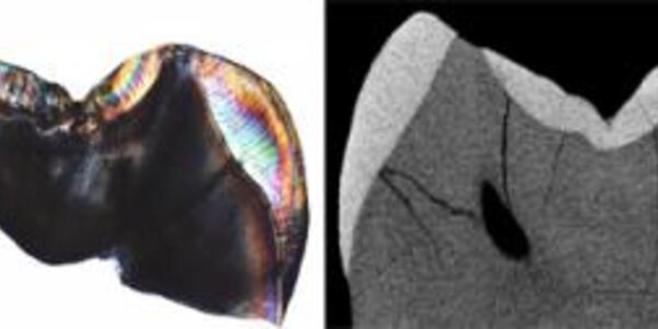 Article teaser image