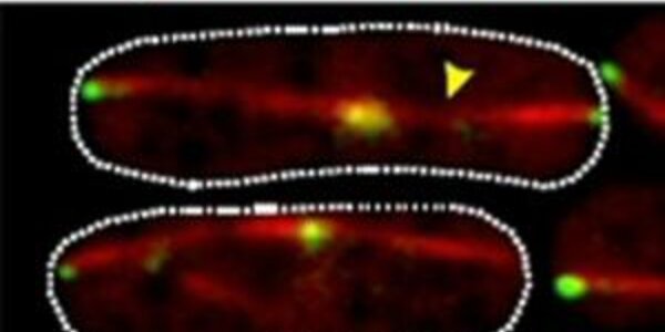 Article teaser image