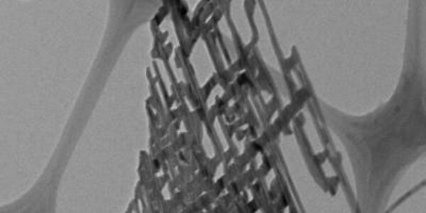 Article teaser image