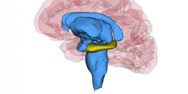 Article teaser image