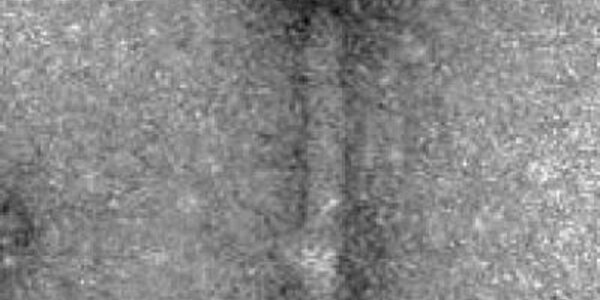 Article teaser image