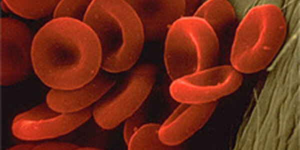 Article teaser image