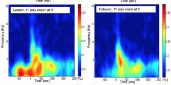 Article teaser image