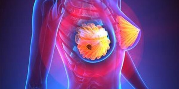 Article teaser image