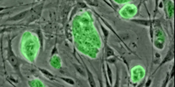 Article teaser image