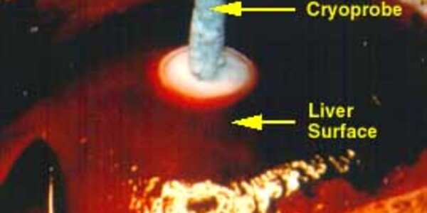 Article teaser image