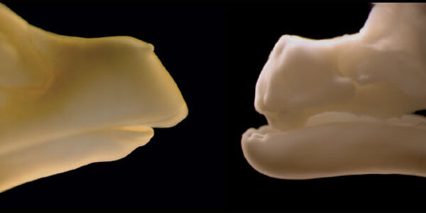 Article teaser image