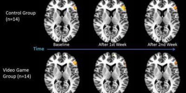 Article teaser image