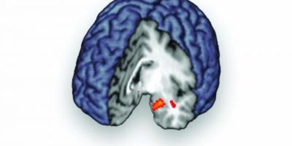 Article teaser image