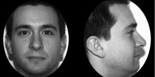 Article teaser image