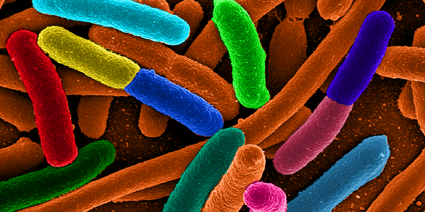 Article teaser image