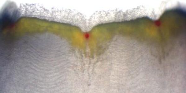 Article teaser image