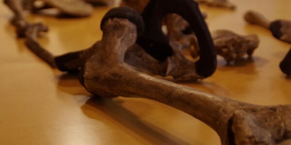 Article teaser image