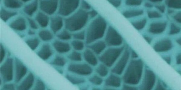 Article teaser image