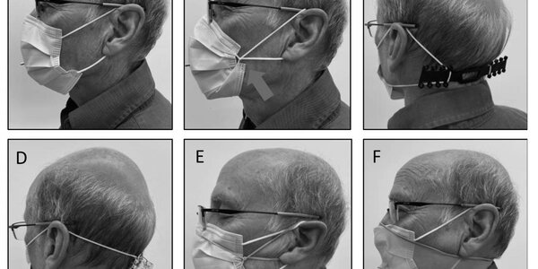 Article teaser image