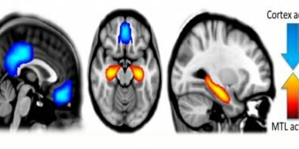 Article teaser image