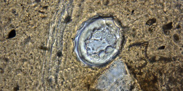 Article teaser image