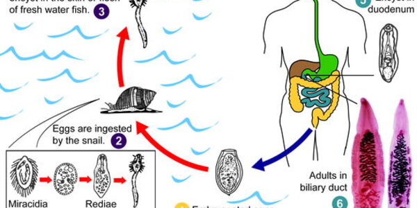 Article teaser image