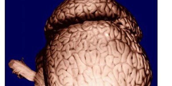 Article teaser image