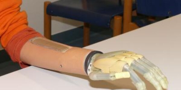 Article teaser image