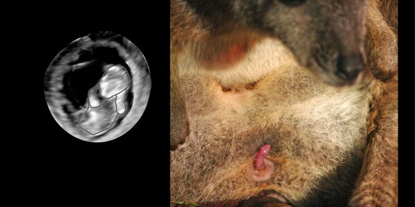 Article teaser image