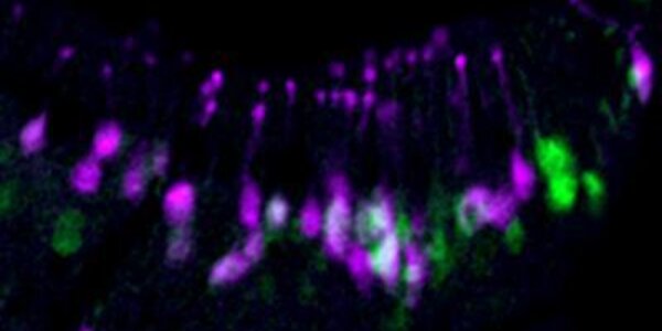 Article teaser image