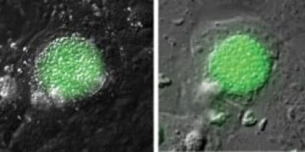 Article teaser image