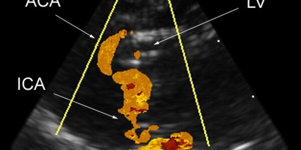 Article teaser image