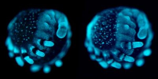 Article teaser image