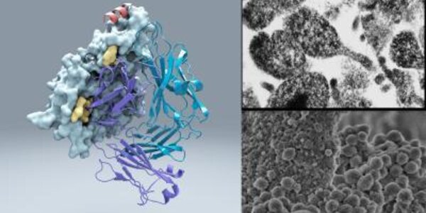 Article teaser image