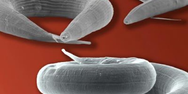 Article teaser image