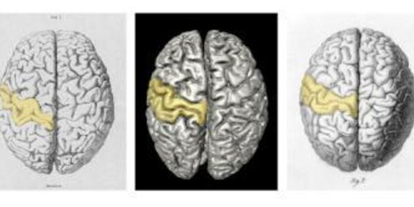 Article teaser image