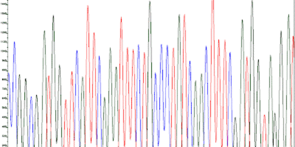 Article teaser image