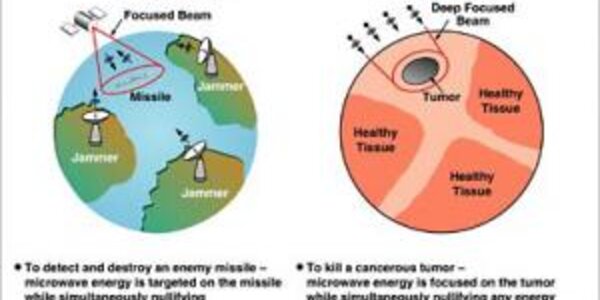 Article teaser image