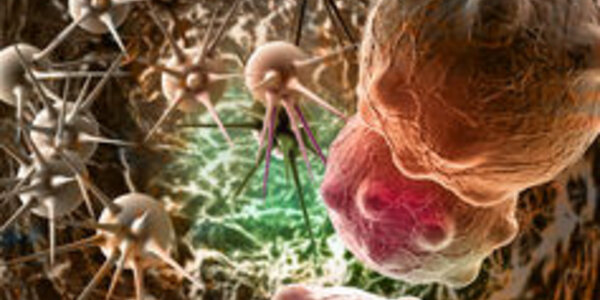 Article teaser image